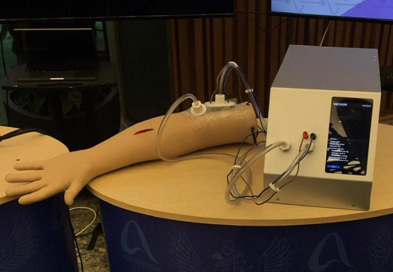 Создан аппарат для лечения ран вакуумом и электричеством в Новосибирске
